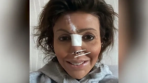 «Пройден длинный путь»: Бывшая жена Аршавина показала новый нос после 12 операций