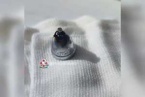 На Урале в лёгких мужчины нашли колокольчик