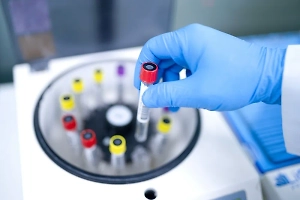 США оплачивали транспортировку 11 тысяч образцов вирусов в Ухань