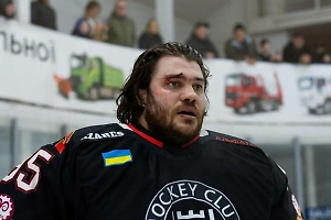 «Великий не заметит комара»: В РФ ответили украинскому вратарю, пожелавшему оторванных ног Овечкину