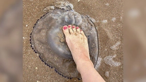 «Щипет, чешется, тошнит»: Нашествие гигантских медуз сорвало отдых туристов на Азовском море