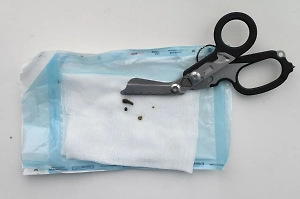 Российские врачи спасли девочку, «пообедавшую» камнями в детском саду