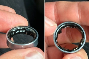  Популярный блогер чуть не лишился пальца из-за умного кольца от Samsung