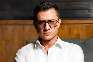 «Заметно после стресса»: Лицо Прилучного вызвало обеспокоенность у пластического хирурга