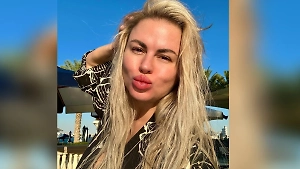 Облысение, рвота и ожирение: Семенович описали будущее с кучей болячек из-за «Оземпика»