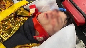 Рэпер VACIO упал с высоты трёх этажей сквозь стеклянную крышу в Париже, он в реанимации