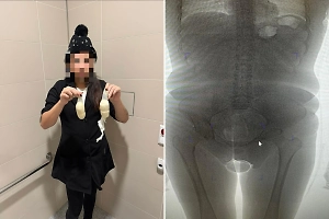 Бразильянка с «начинкой» из кокаина попалась на таможне в России