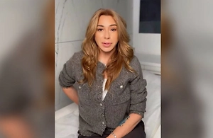 «Не ложитесь под нож»: Алёна Апина раскрыла секрет своего преображения без пластики