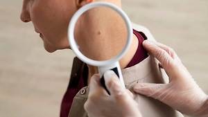 Онколог объяснила, почему вакцина не вылечит папиллому