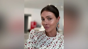 «Не нужно увлекаться инъекциями»: Экс-жена Аршавина рассказала всю правду о потере носа