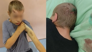 Постояльцев «прокопьевского чистилища» жестоко избивали и держали на цепи