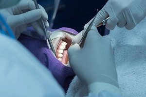 Россиянам рассказали, как не стать жертвами стоматологического обмана