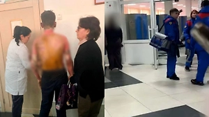 Три школьника пострадали в Красноярске в устроенном восьмиклассницей пожаре