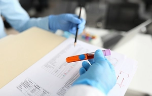 ЗППП, удалённая простата и преддиабет: Врач расшифровал анализы Джеффри Эпштейна